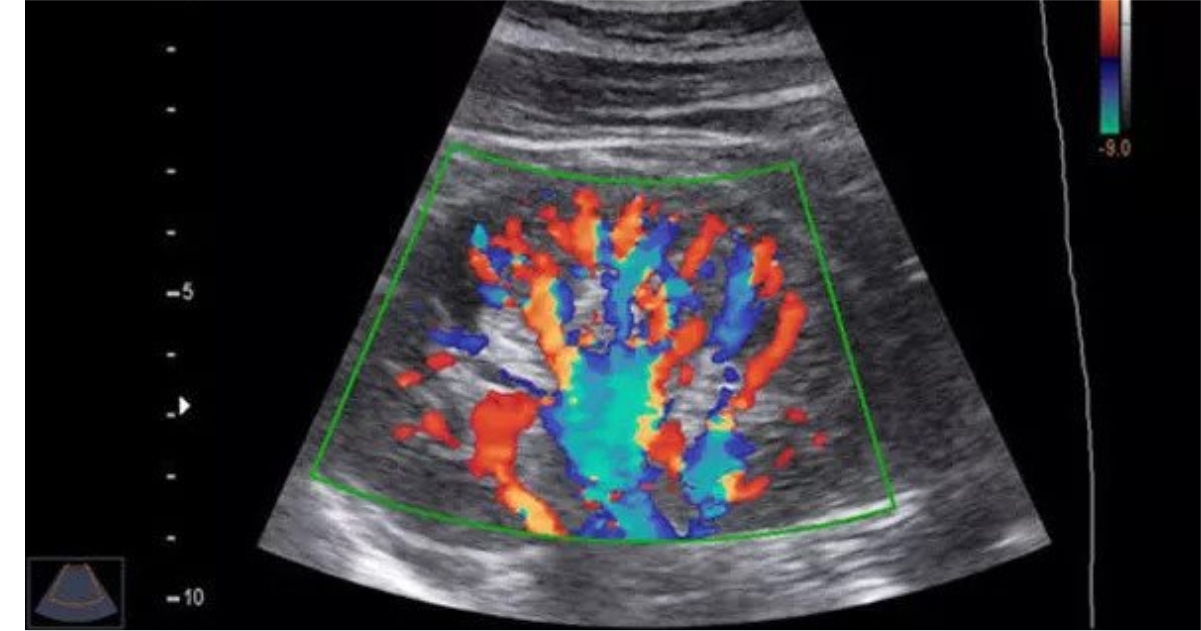 colour-doppler-test-cost-colour-doppler-ultrasound-price-near-me