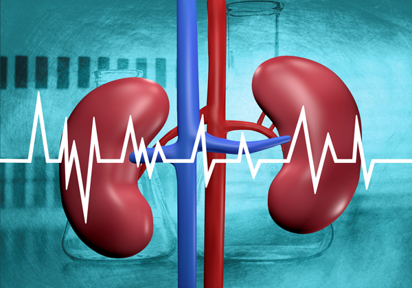 renal artery stent